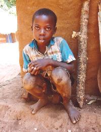 Adopce na dlku - jak vypad v Ugand?